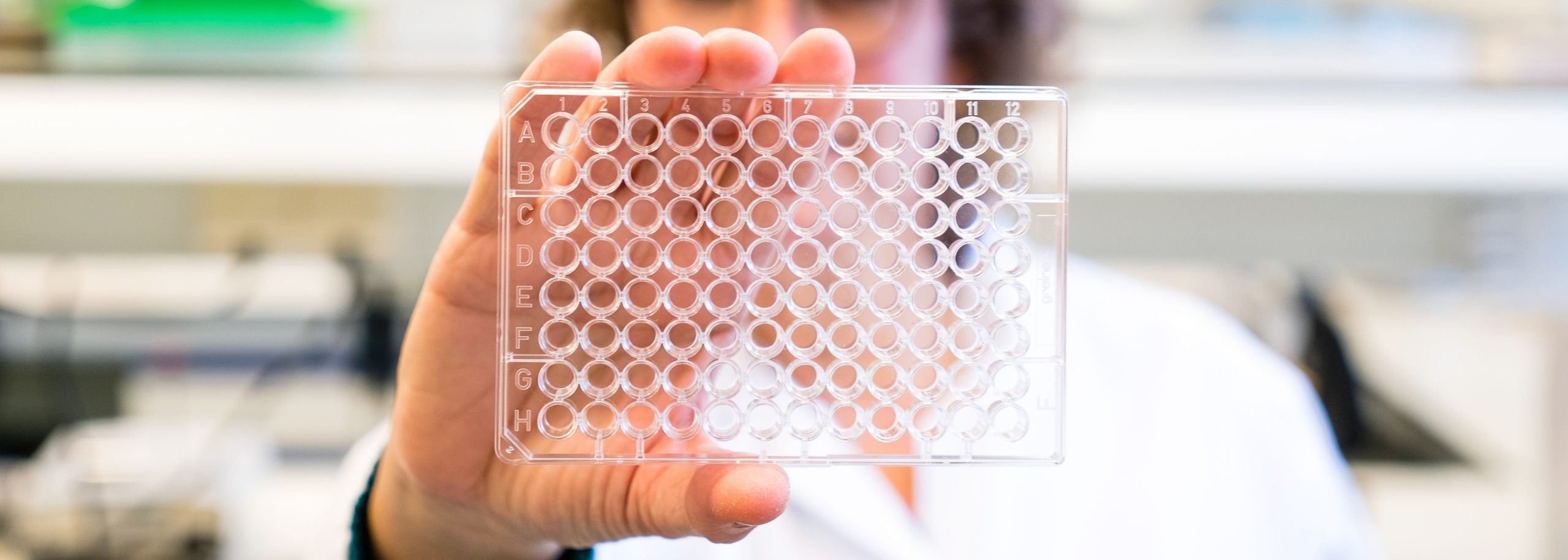 Wiep Scheper proefdiervrij Alzheimer model