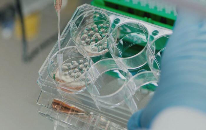 Inschrijven Willy van Heumenprijs wetenschap prijs onderzoek