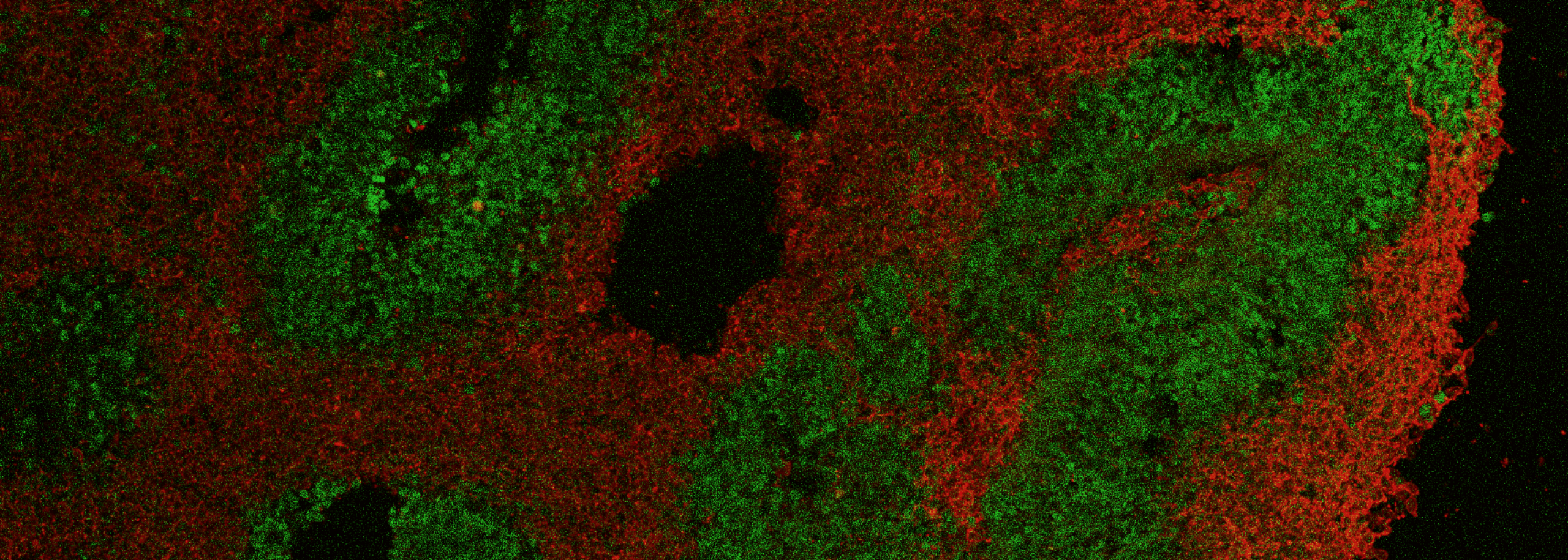 organoid gutvibrations