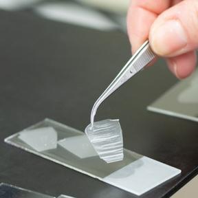 Huidmodel (288 x 288) Huidmodel